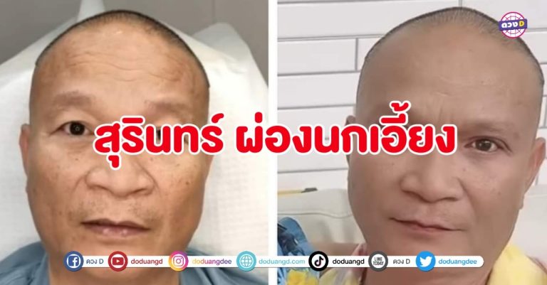 ศัลยกรรม ทำแล้วดี ล่าสุด หม่ำ จ๊กมก อวดตาคู่ใหม่ ไฉไล แป๋วแหวว